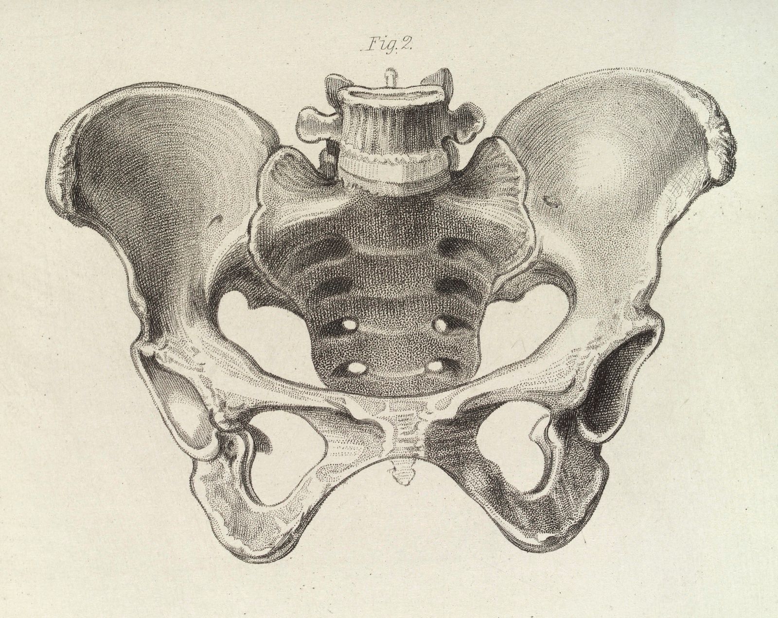 An engraving of the bony female pelvis seen from the front, from an obstetrical text, a Wikimedia Commons photograph in the encyclopedia of Candace Cooley