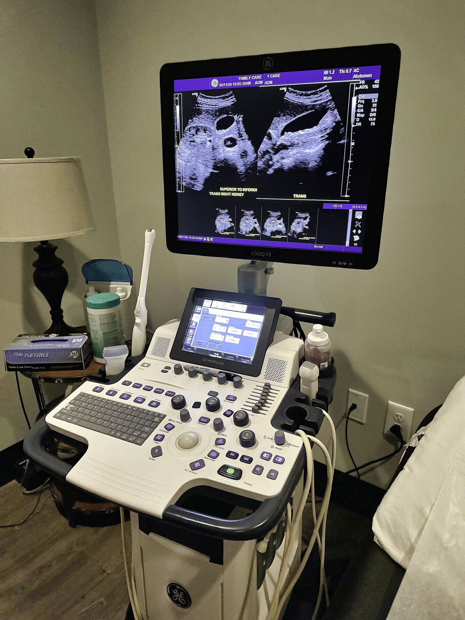 A modern medical ultrasound scanner in an empty exam room, a Wikimedia Commons photograph in the encyclopedia of Candace Cooley